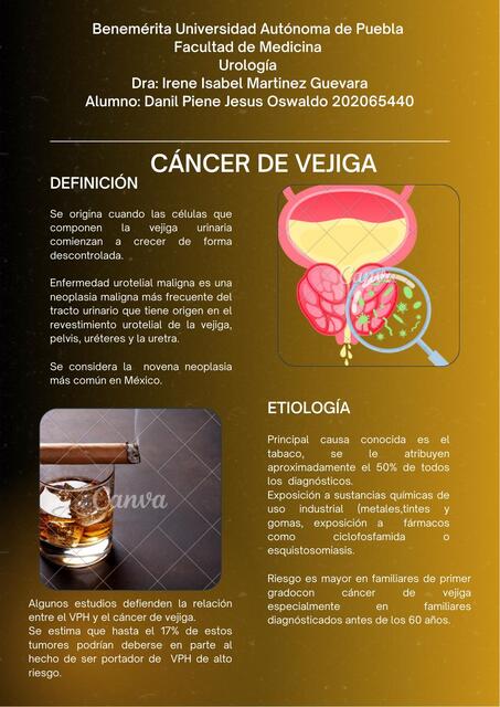 CANCER DE VEJIGA RESUMEN