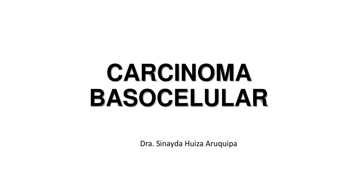 CARCINOMA BASOCELULAR