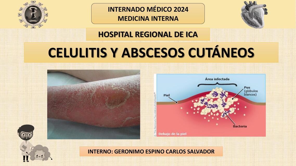 CELULITIS Y ABSCESOS CUTÁNEOS