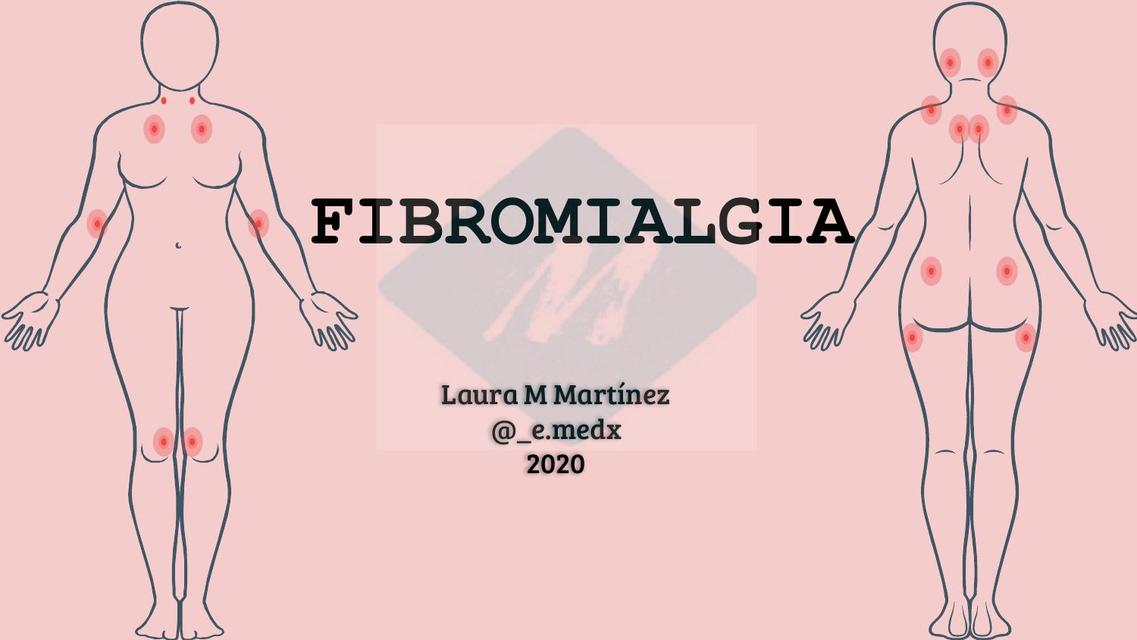 Fibromialgia