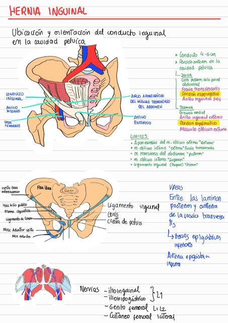 Hernia Inguinal