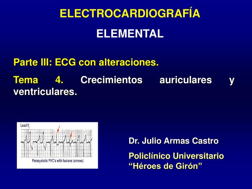 ECG Curso 3