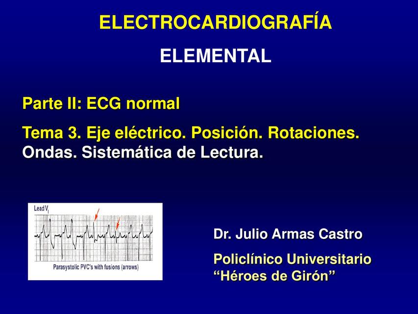 ECG Curso 2