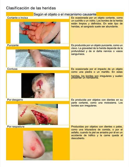 pdf clasificacion de las heridas compress 1