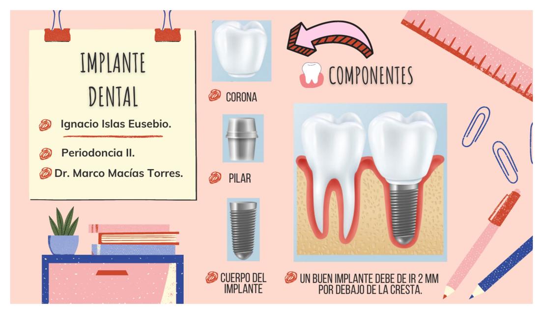 Implante dental