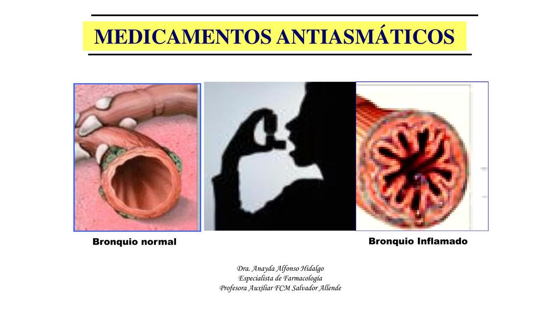 Conferencia antiasmáticos