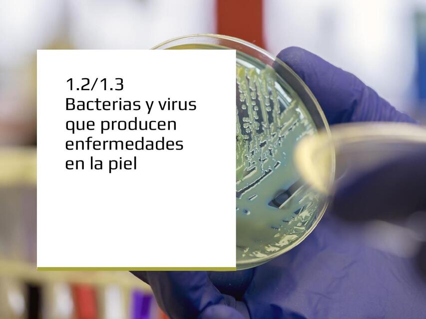 enf virus y bacterias