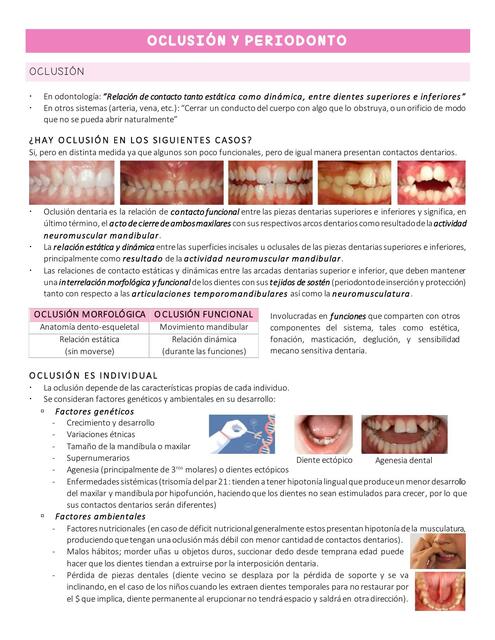 Oclusión y Periodonto p1