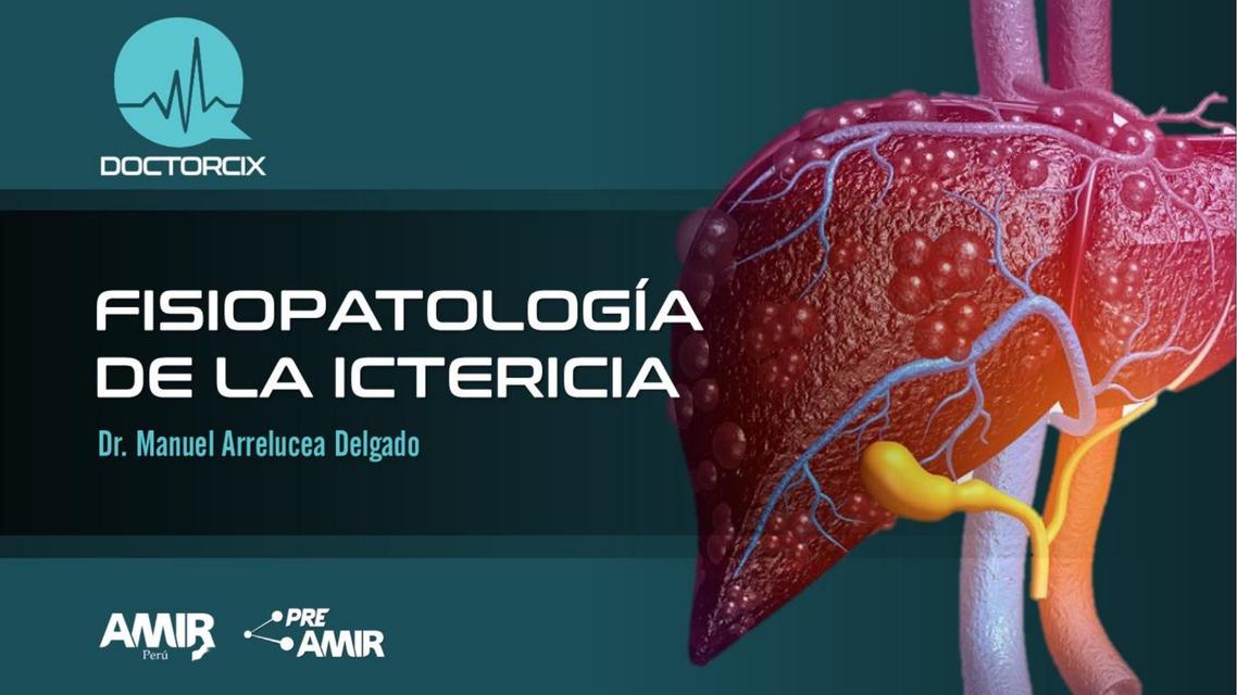 FISIOPATOLOGÍA Y ASPECTOS CLÍNICOS DE LA ICTERICIA