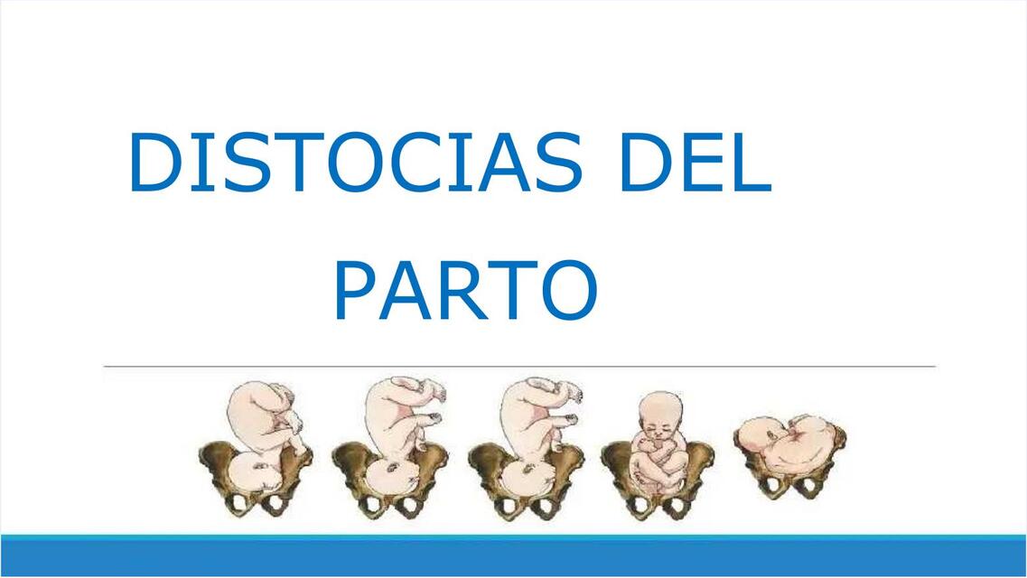 distocias del parto