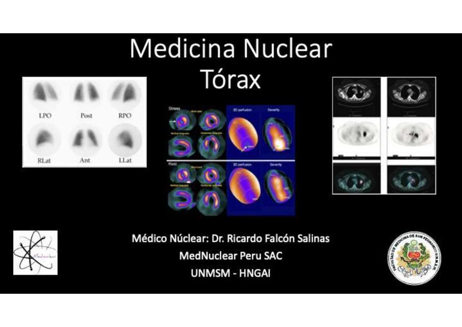 II 7 MEDICINA NUCLEAR EN PATOLOGÍA TORÁCICA DR ALB