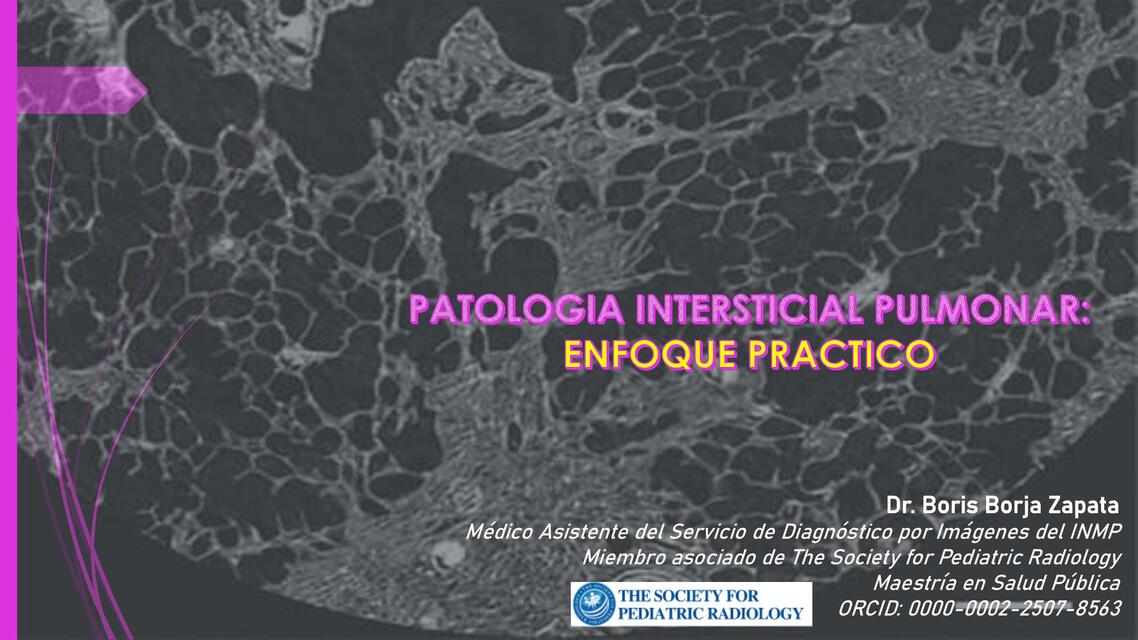 II 4 PATOLOGÍA INTERSTICIAL PULMONAR ENFOQUE PRÁCT