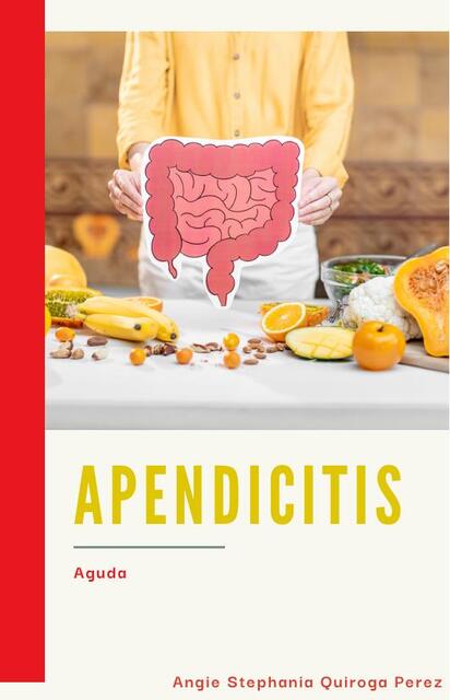 APENDICITIS AGUDA