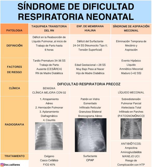 SINDROME DE DIFICULTAD RESPIRATORIA NEONATAL