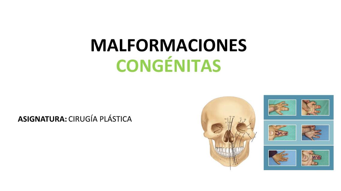 MALFORMACIONES CONGENITAS EN CIRUGIA PLASTICA