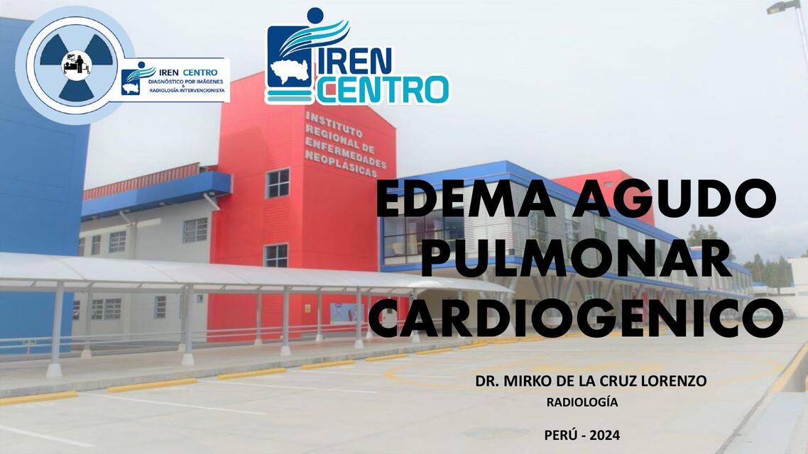 III 4 EDEMA AGUDO PULMONAR CARDIOGENICO DR MIRKO D