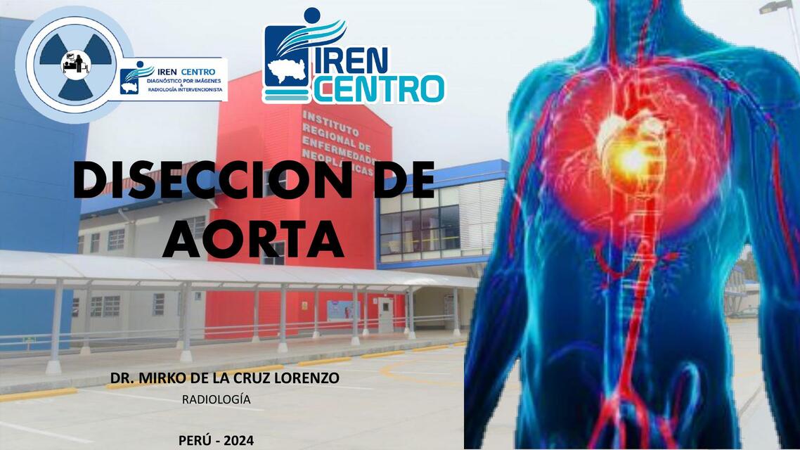 III 3 ANEURISMA Y DISECCION DE AORTA DR MIRKO DE L