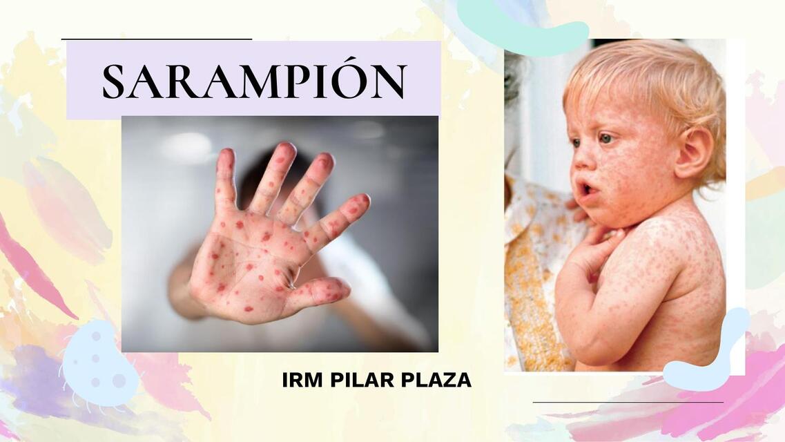 SARAMPION