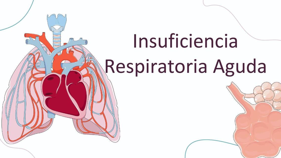 INSUFICIENCIA RESPIRATORIA AGUDA