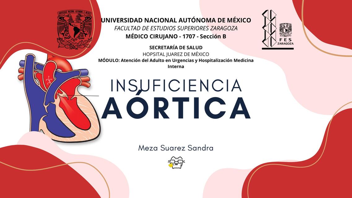 Insuficiencia Aórtica