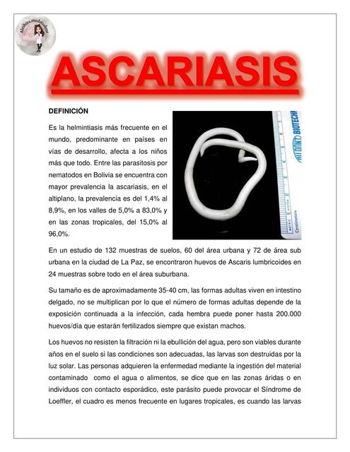 ASCARIASIS