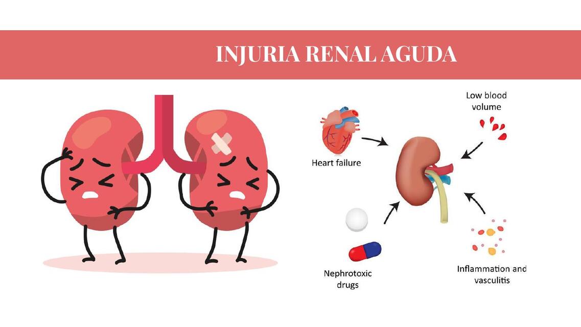 INJURIA RENAL AGUDA AKI