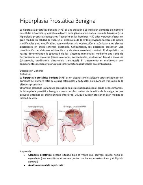 Hiperplasia Prostática Benigna