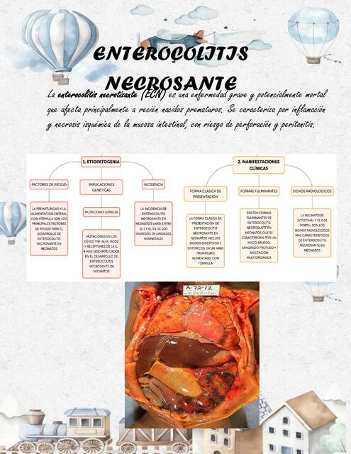 ENTEROCOLITIS NECROSANTE