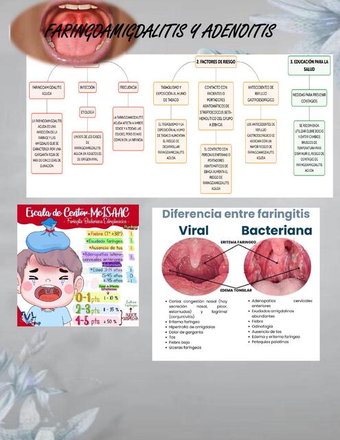 faringoamigdalitis