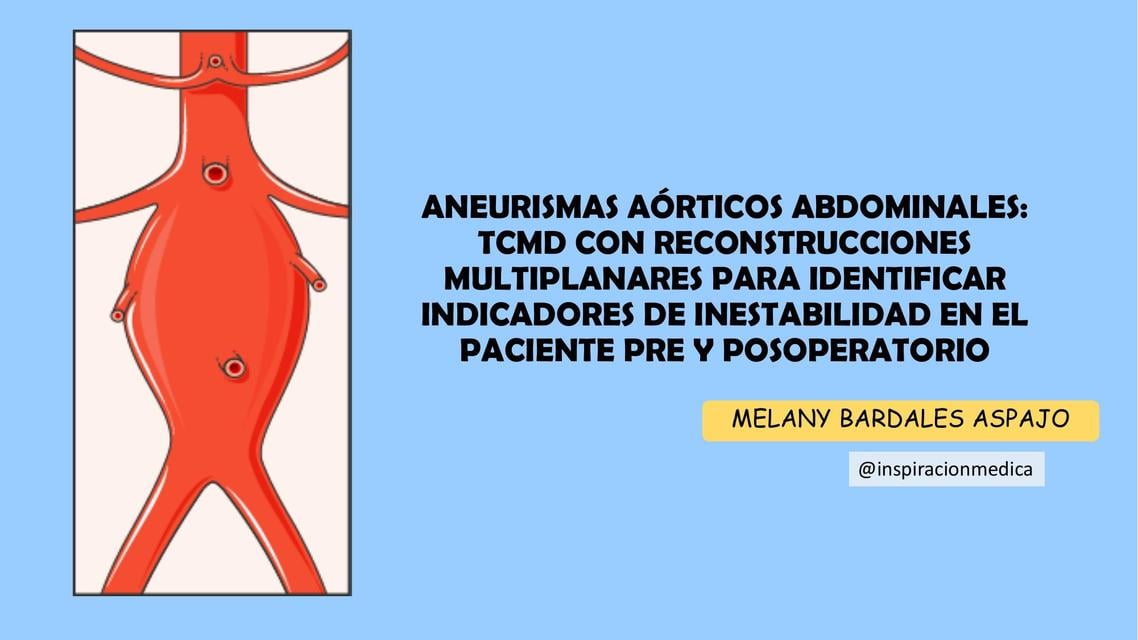 ANEURISMAS AÓRTICOS ABDOMINALES | Melany Bardales | uDocz