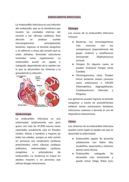 ENDOCARDITIS INFECCIOSA