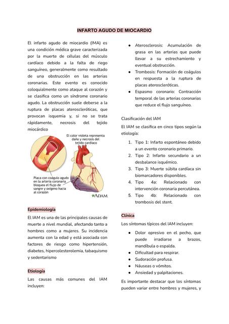 INFARTO AGUDO DE MIOCARDIO