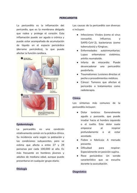 PERICARDITIS