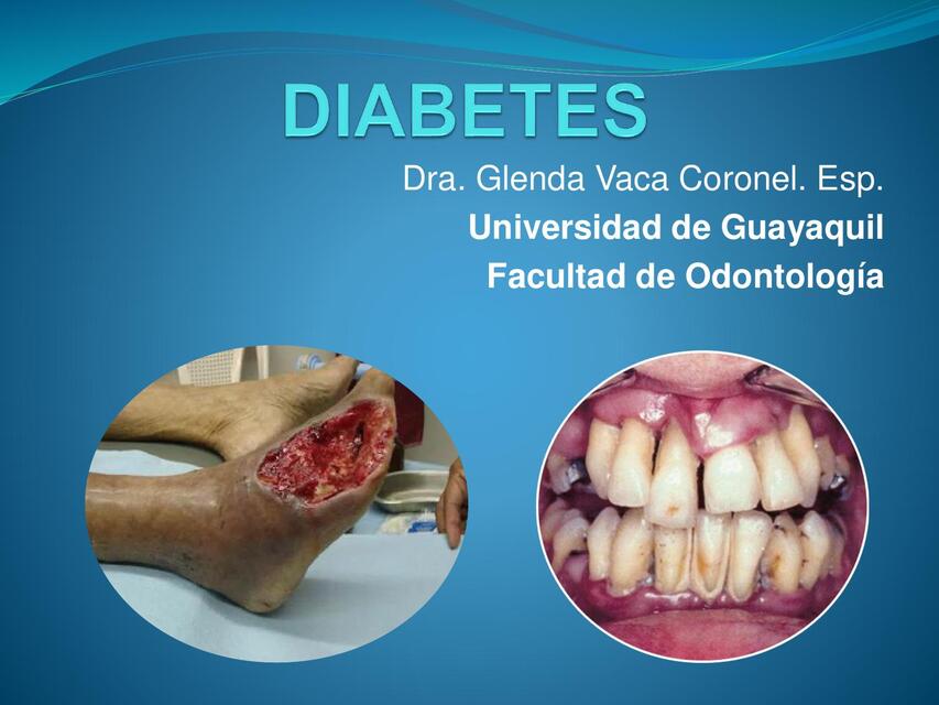 CLASE GUÍA DIABETES