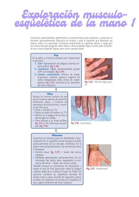 Exploración musculo esquelética de la mano 1