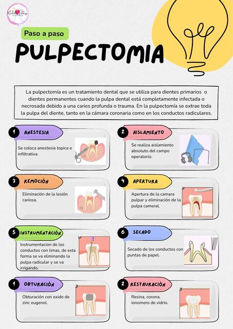 Pulpectomia