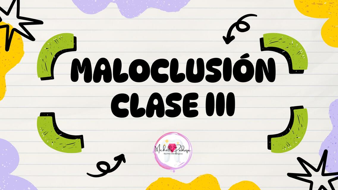 maloclusión clase III