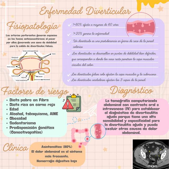 Enfermedad Diverticular