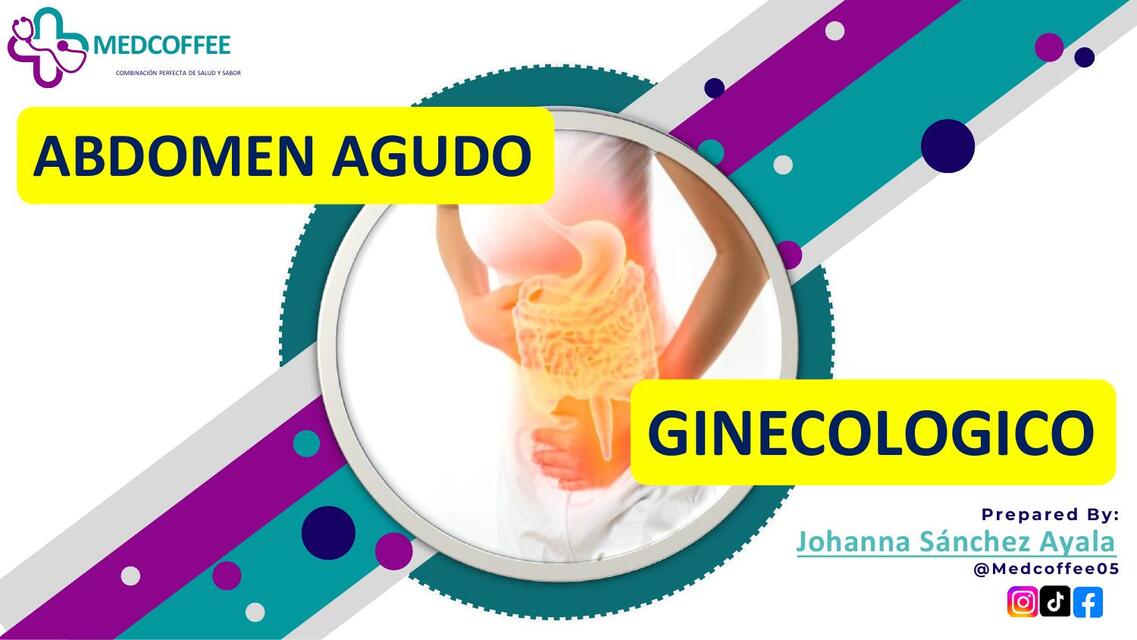 Abdomen agudo ginecológico