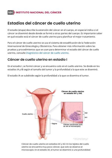 Estadios del cáncer de cuello uterino