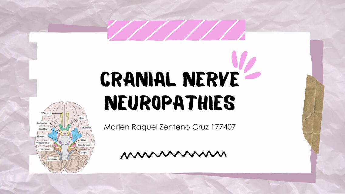 Cranial Nerve Neuropathies pdf