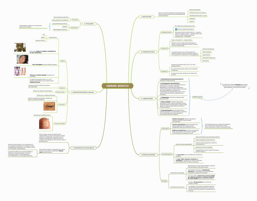 Sindrome Nefrotico