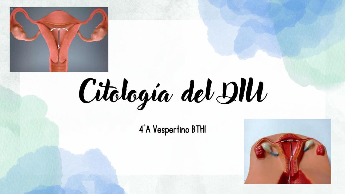 Citología del DIU