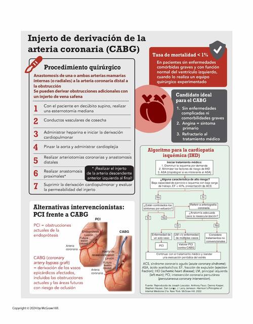 Injerto de derivación de la arteria coronaria