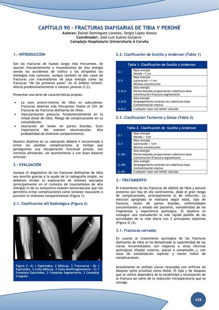 Frácturas diafisiarias de tibia y peroné