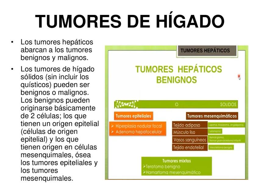 TUMORES DE HÍGADO