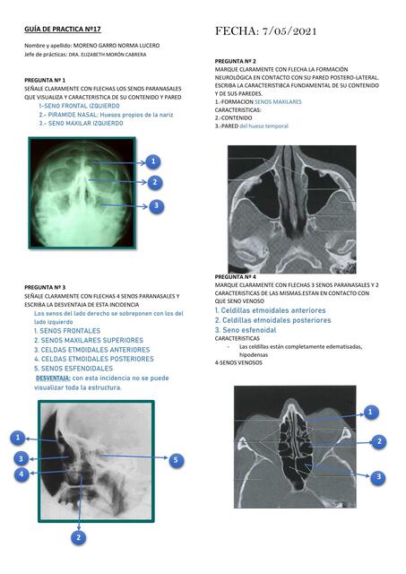 GUÍA PRACTICA N 17