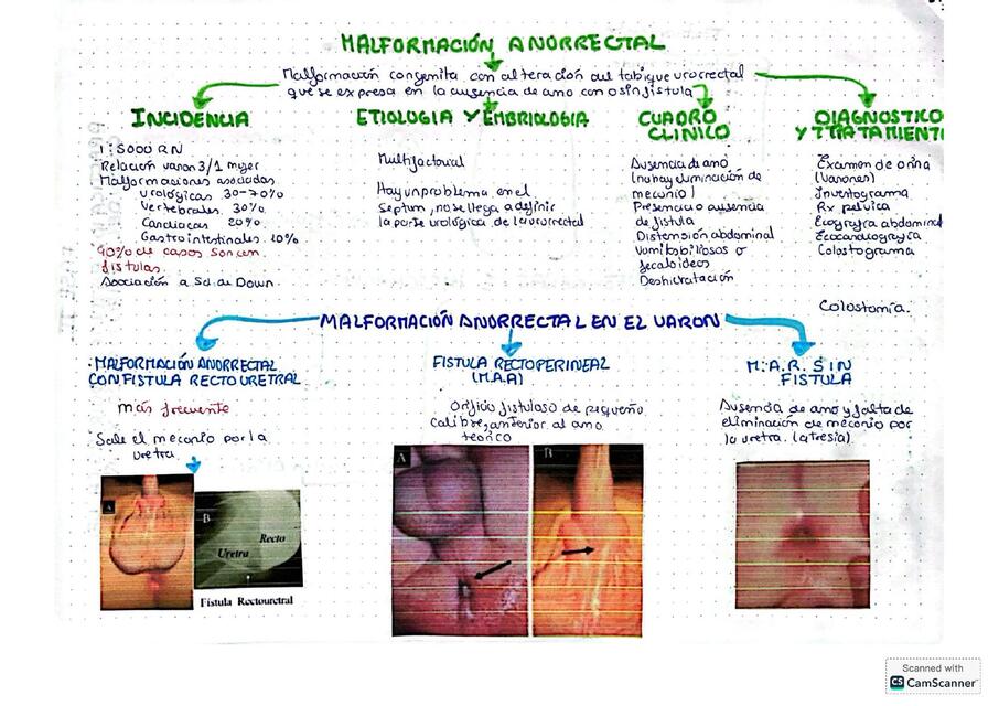 MALFORMACIÓN ANORRECTAL