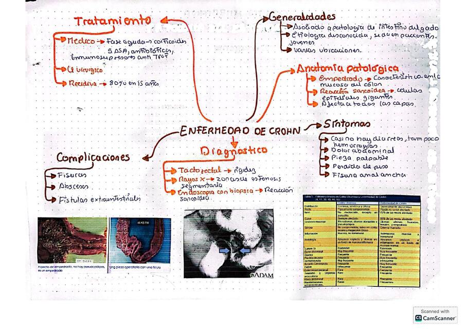 ENFERMEDAD DE CROHN