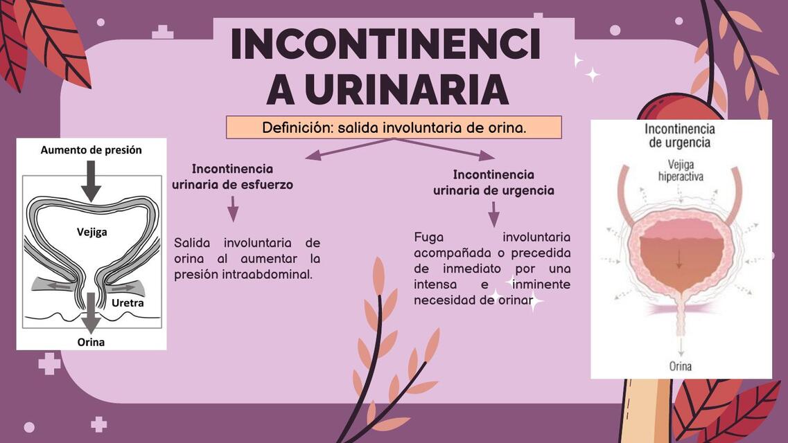 INCONTINENCIA URINARIA